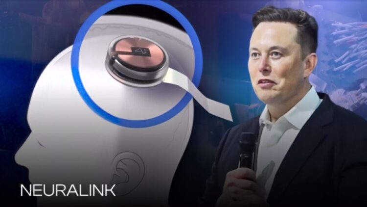 Historic breakthrough in Canada—two patients with spinal cord injuries manage to move a cursor with their minds after receiving a Neuralink brain implant 1 Historic breakthrough in Canada—two patients with spinal cord injuries manage to move a cursor with their minds after receiving a Neuralink brain implant