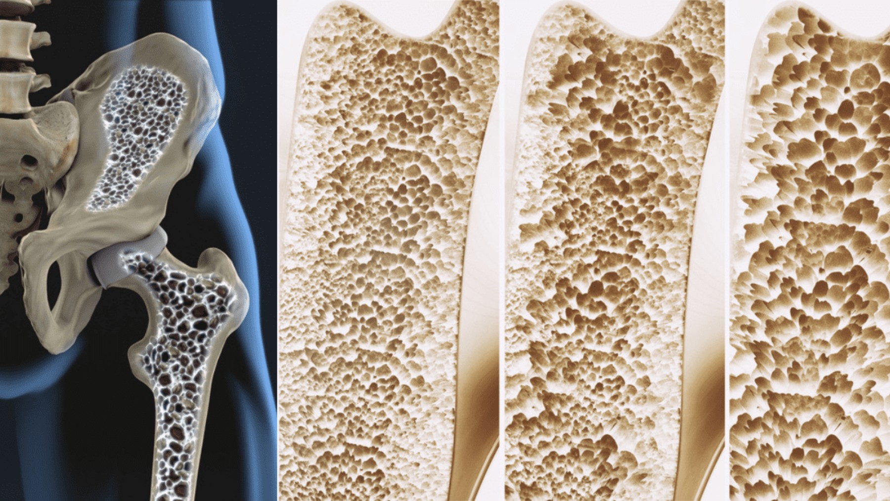 It's official—scientists find the “biological switch” that strengthens bones and could end osteoporosis