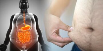 Goodbye to the most dangerous fat in the body—science confirms how to eliminate visceral fat without surgery and improve your quality of life