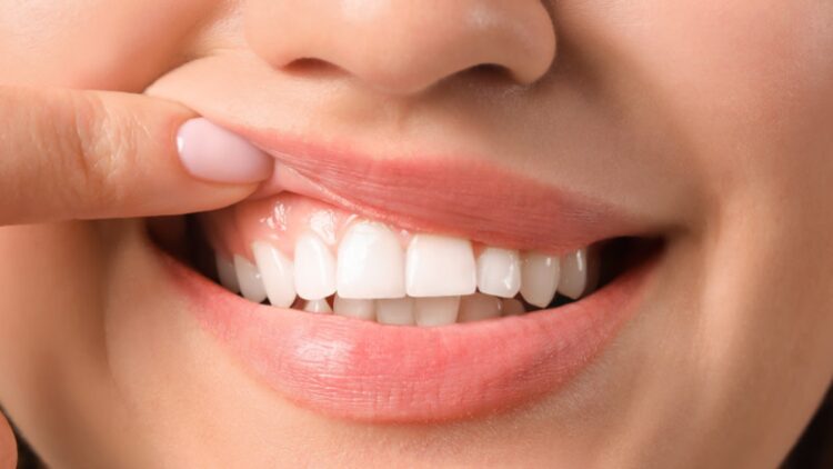 Confirmed—Scientists develop a gel that repairs tooth enamel and could eliminate cavities forever
