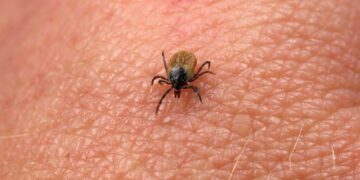 Bad news for dog owners—newly discovered bacteria casts doubt on safety of tick bites—here are the precautions you should take 17 Bad news for dog owners—newly discovered bacteria casts doubt on safety of tick bites—here are the precautions you should take