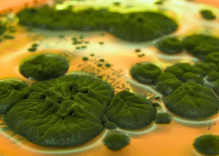 Researchers confirm that a fungus in Chernobyl could use radiation as an energy source, changing everything we knew 1 Researchers confirm that a fungus in Chernobyl could use radiation as an energy source, changing everything we knew